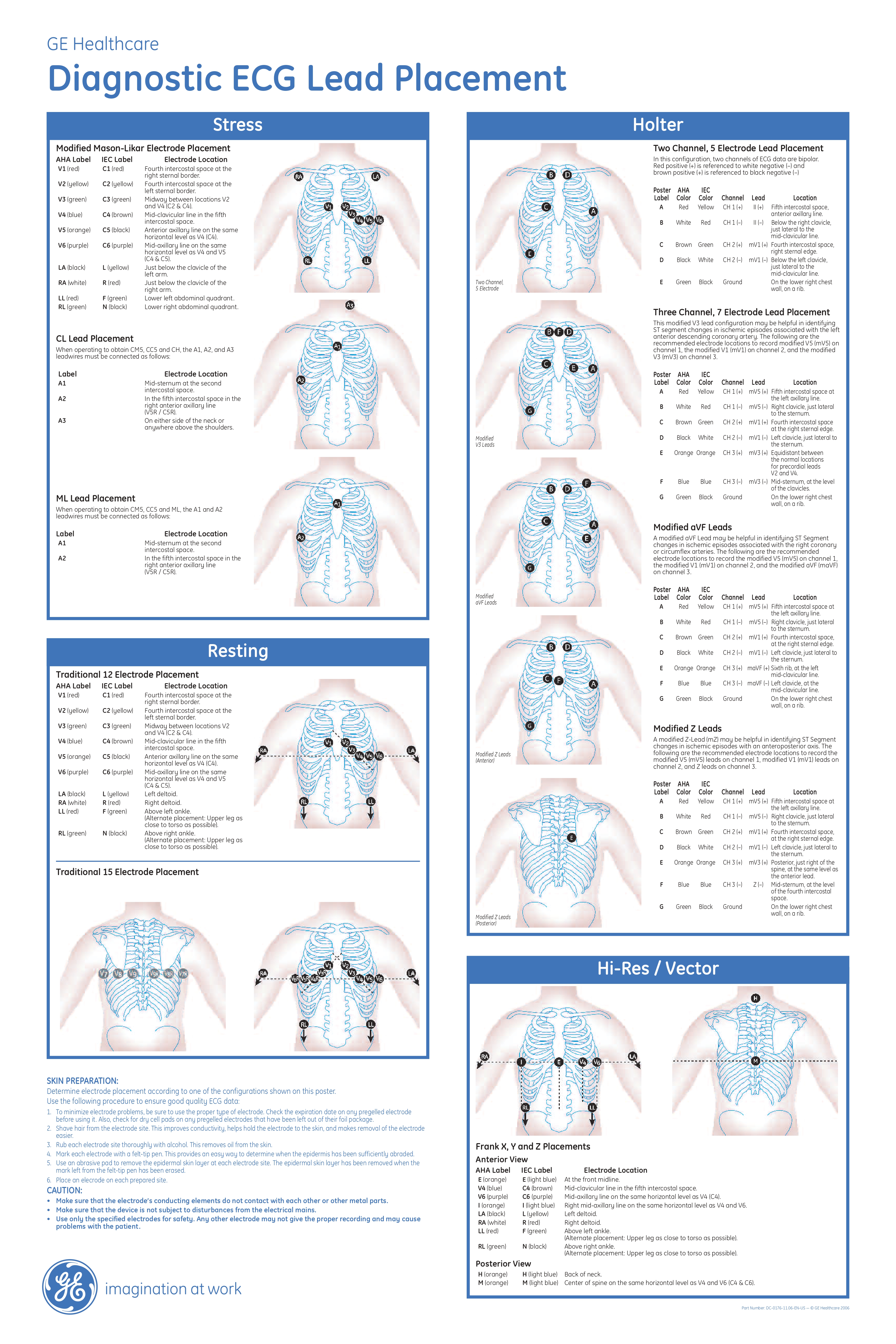 ECG Lead Placement Poster