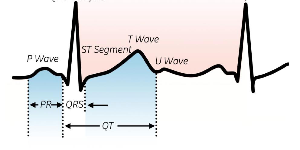 Determination of the QT interval