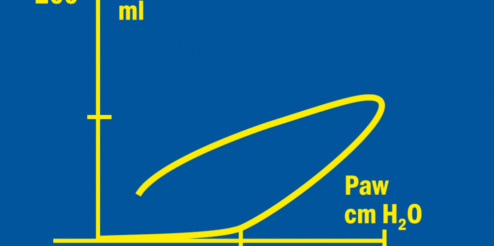 Patient spirometry pressure/volume loop example