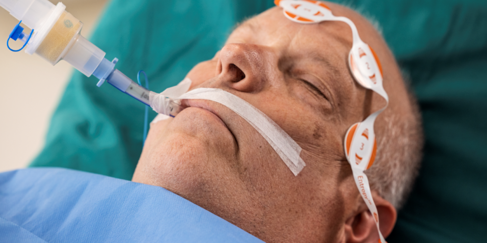 Patient under anesthesia with Entropy sensors