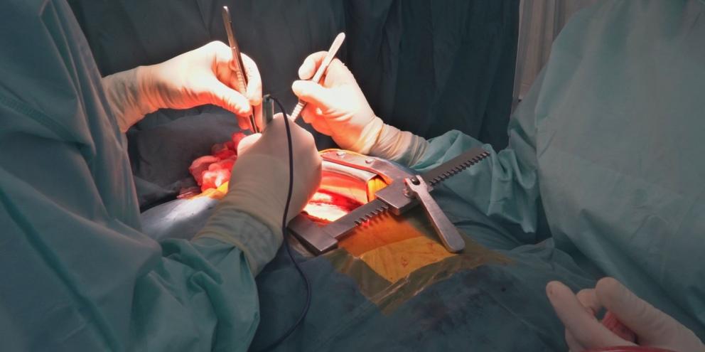 Two clinicians performing cardiopulmonary bypass surgery on a patient