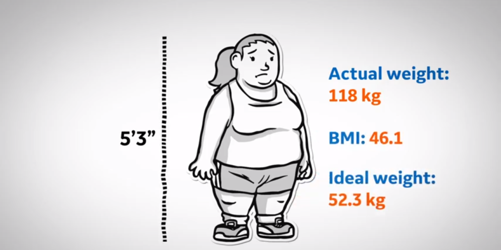 Morbid obese woman animation