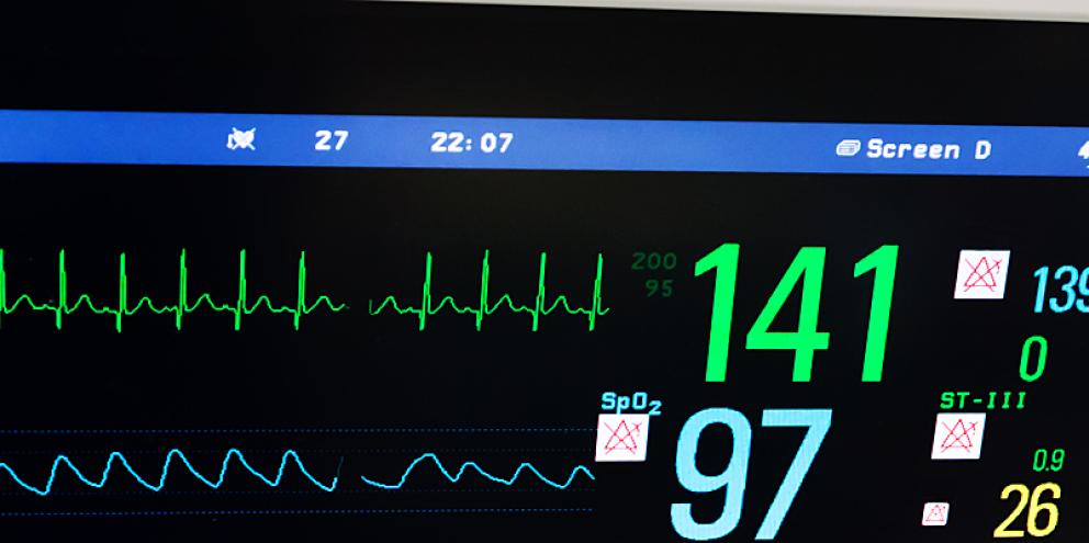 Neonatal Heart Rate Monito