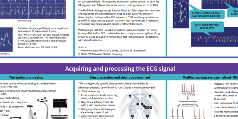 Poster recognition and quantification of T-Wave Alternans (TWA)