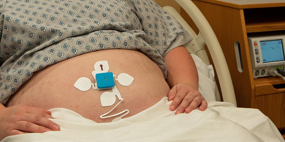 Pregnant woman attached to fetal monitor