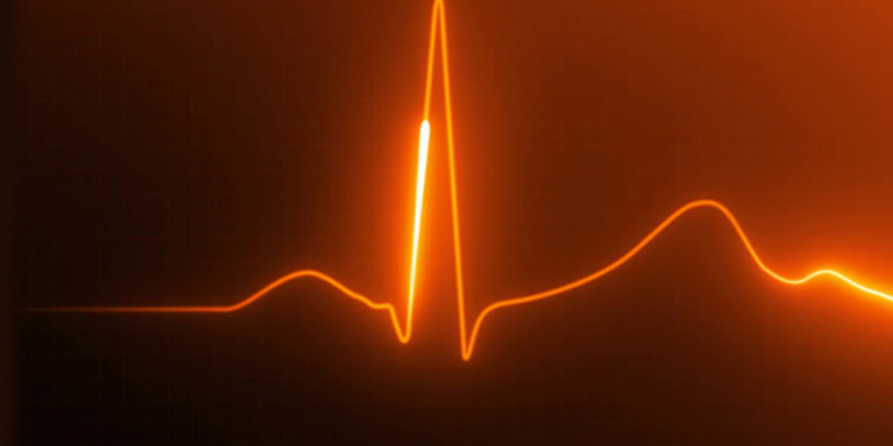 QT interval