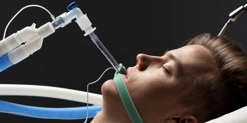 Intubated patient