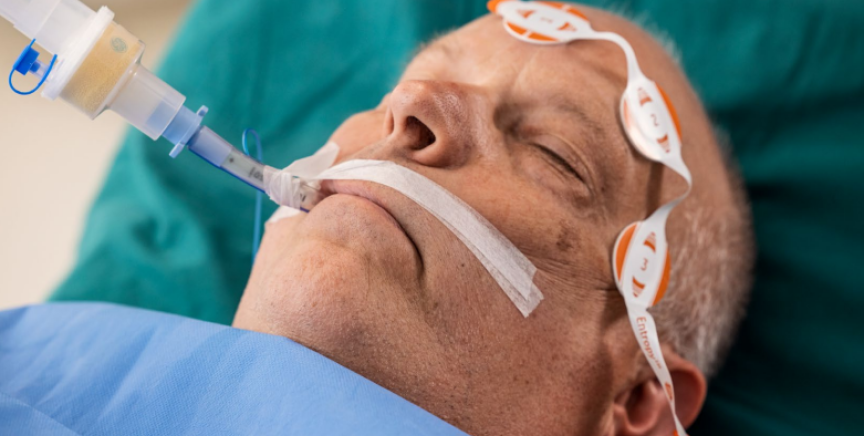 Intubated patient with Entropy sensor