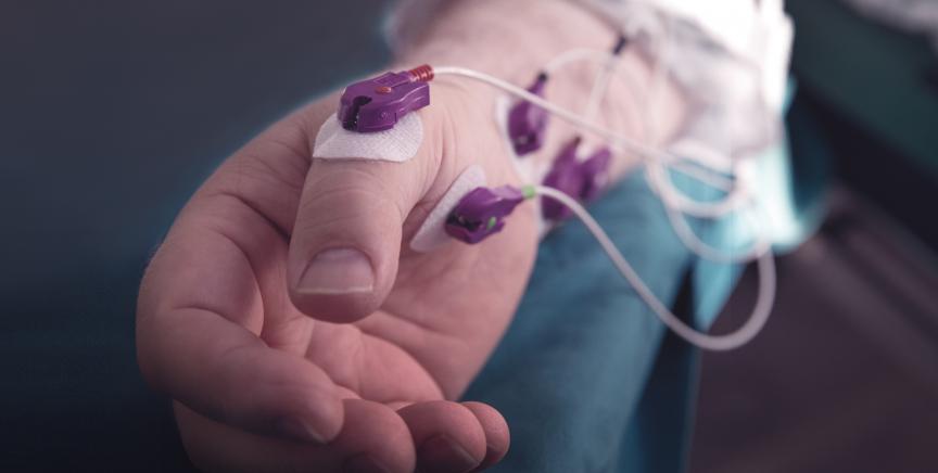 EMG sensors