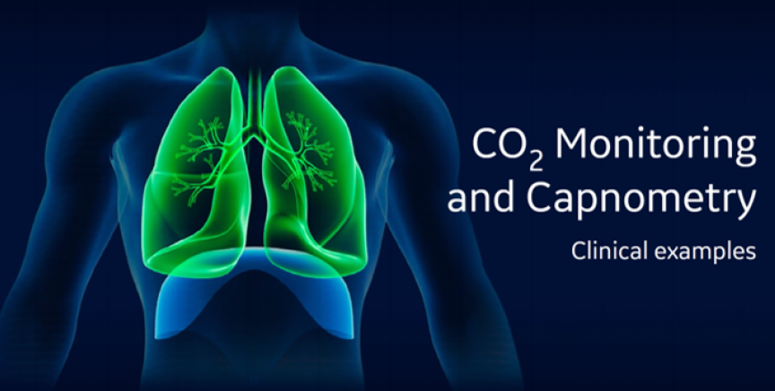 CO2 monitoring and Capnometry banner