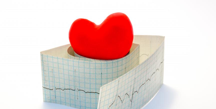 ECG print