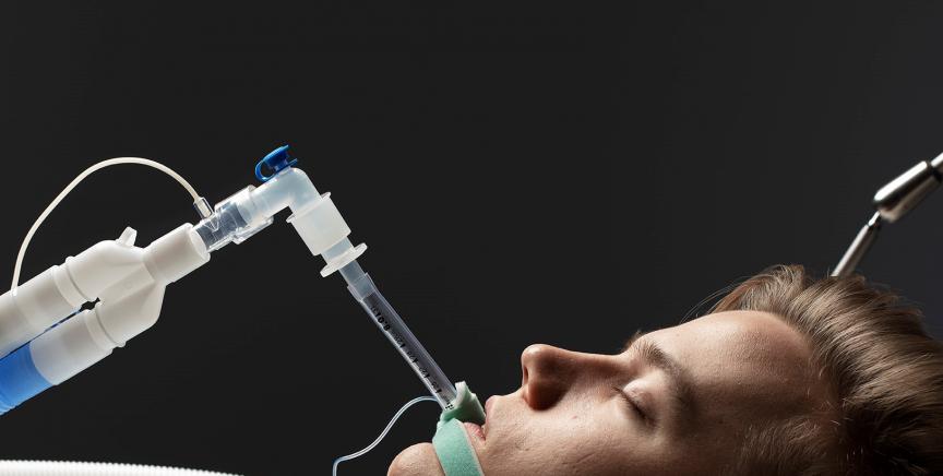Intubated patient
