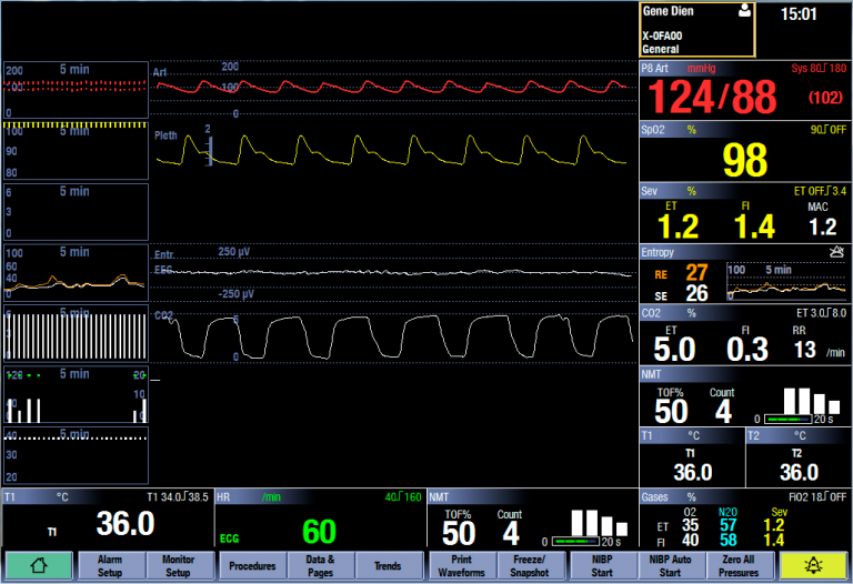 Entropy shown in the waveform field