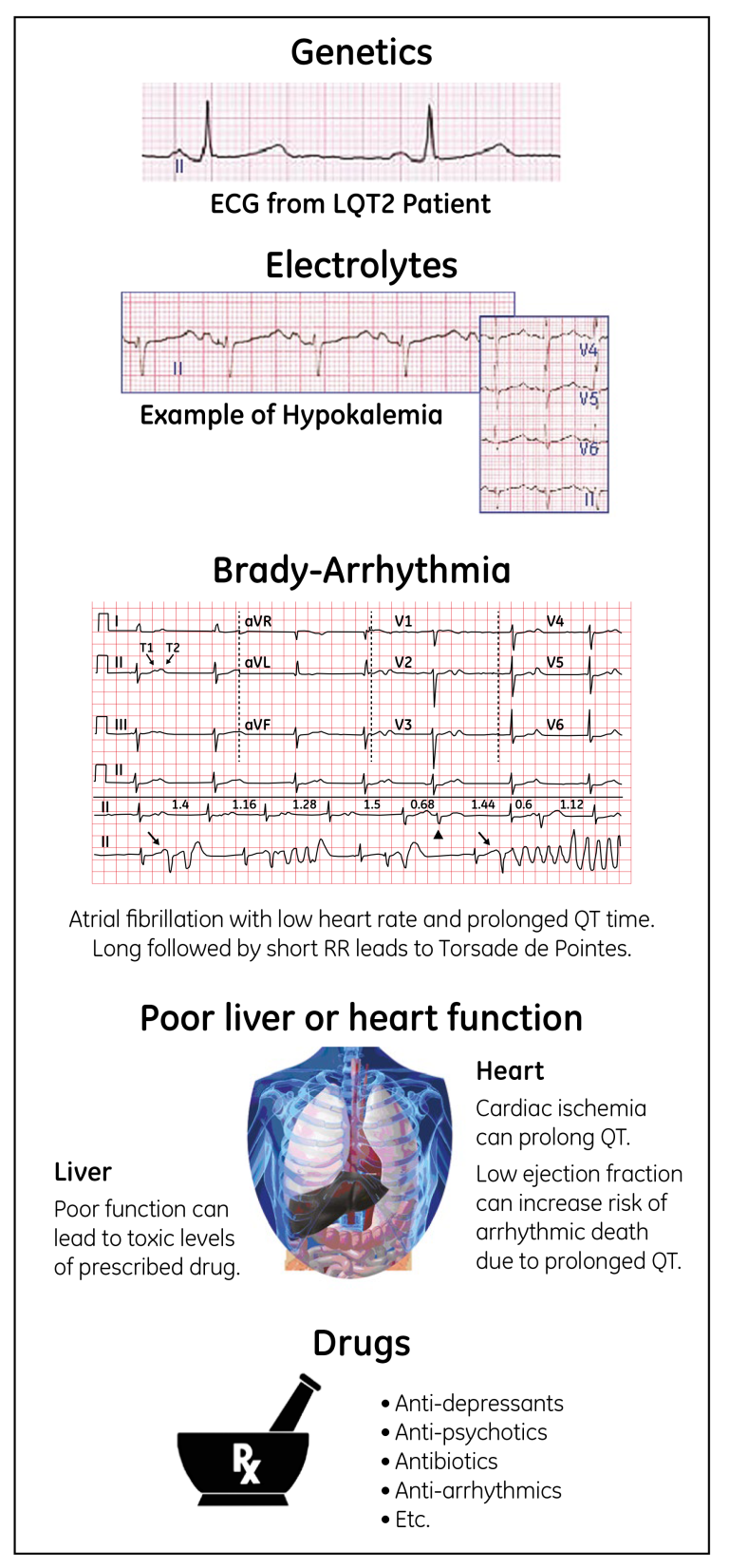 Figure 2. Risk factors