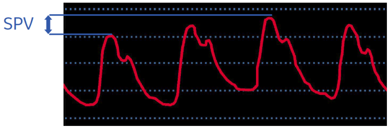 SPV curve