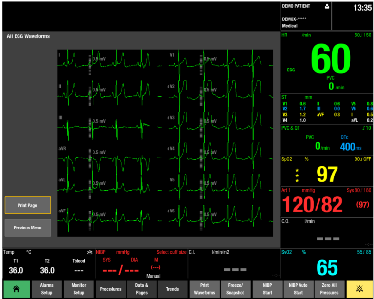 12 waveforms in monitor screen