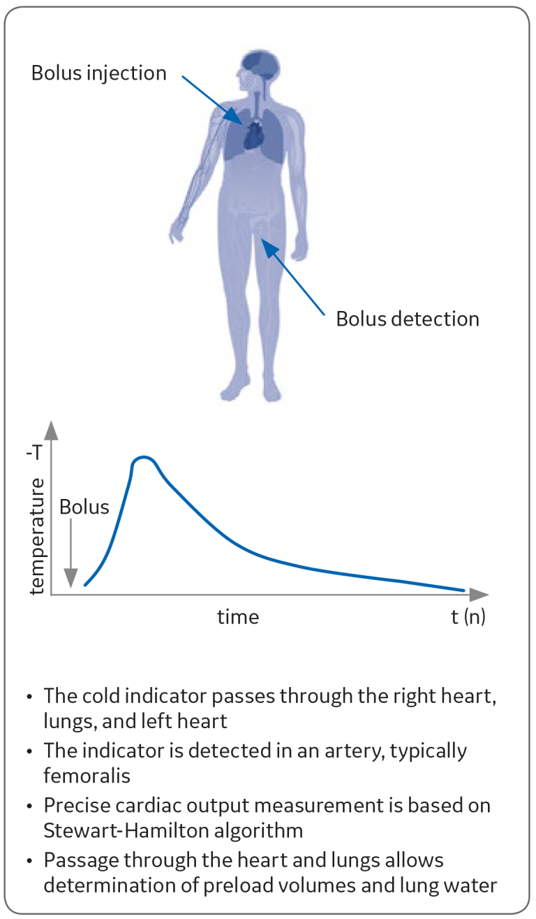 Change of temperature with time in a transpulmonary thermodilution 