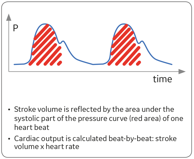 Graph showing pulse contour analysis