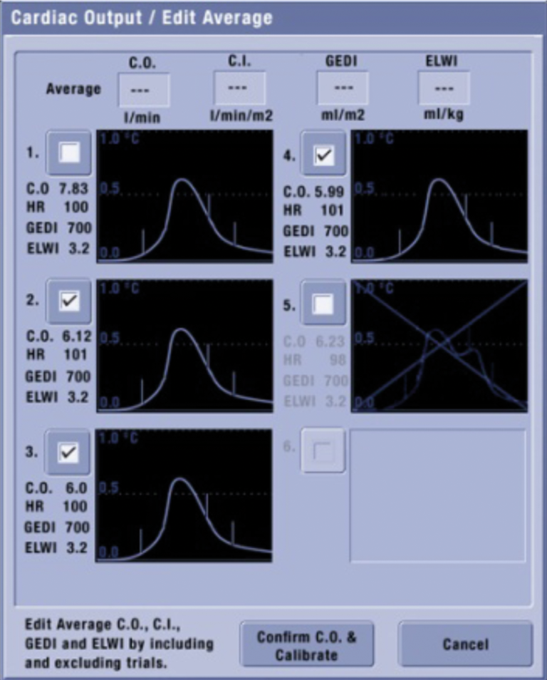 Transpulmonary thermodilution curves