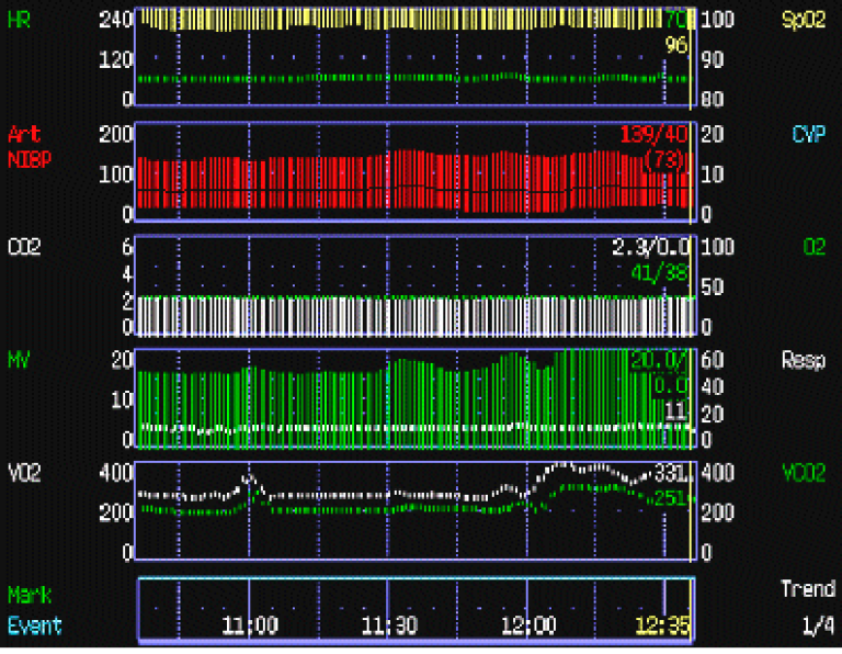 Screenshot of 40 year-old male respiratory data