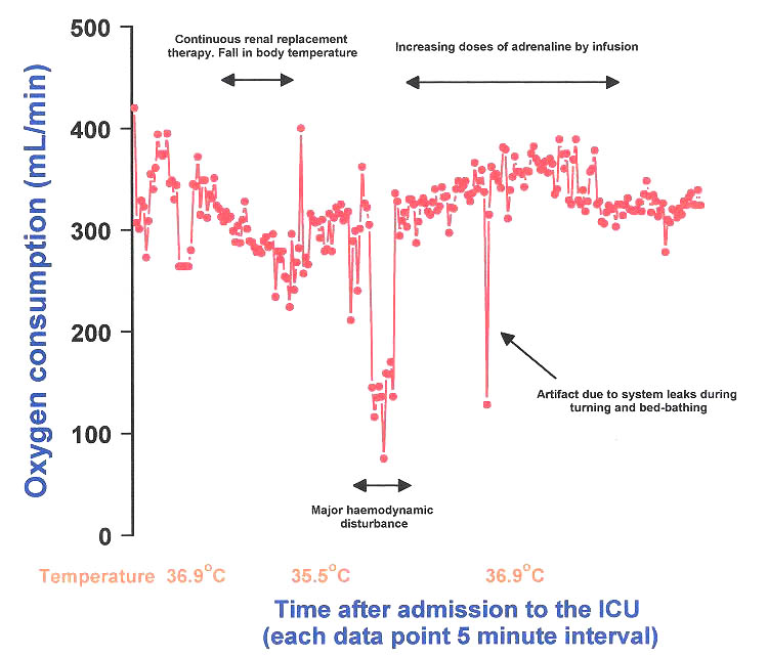 Metabolic data of a 72 year old patient admitted in the ICU