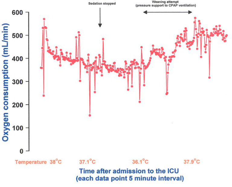 77 year-old female metabolic monitoring data with a perforated diverticulum