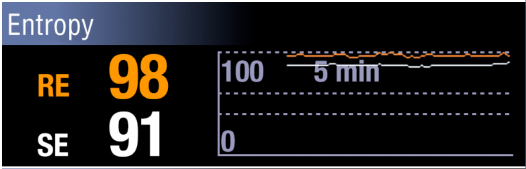 Entropy monitor displaying a difference between the two Entropies, indicating muscle activity on the face