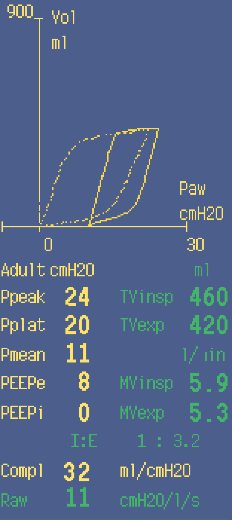 Pressure/Volume loop showing best possible PEEP