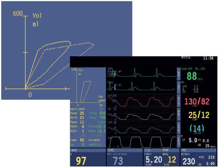Spirometry split screen of spirometry loops and numerical values.