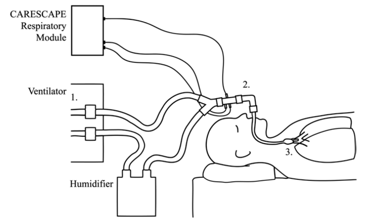 Spirometry measurement sites