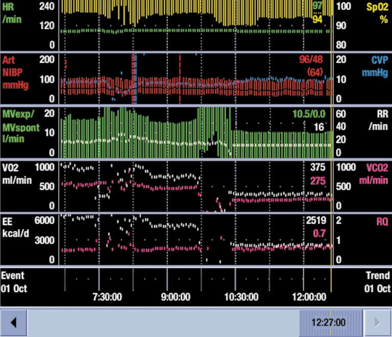 Screen displaying work of breathing