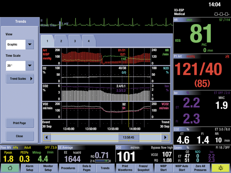 Screen displaying severe bleeding during surgery