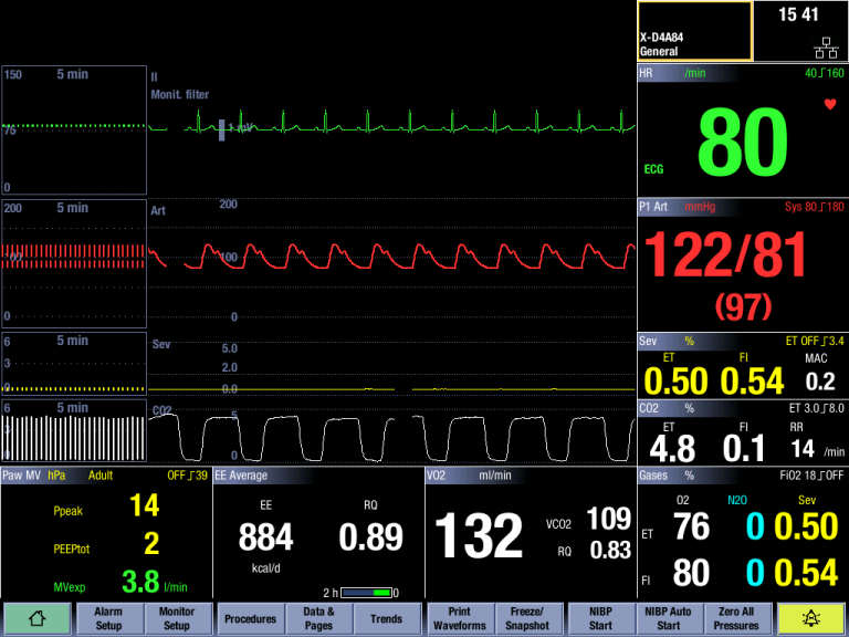 Gas Exchange monitor