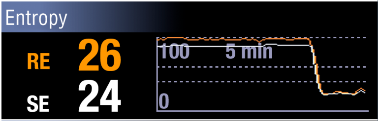 Entropy monitor displaying the moment when patient loses responsiveness.