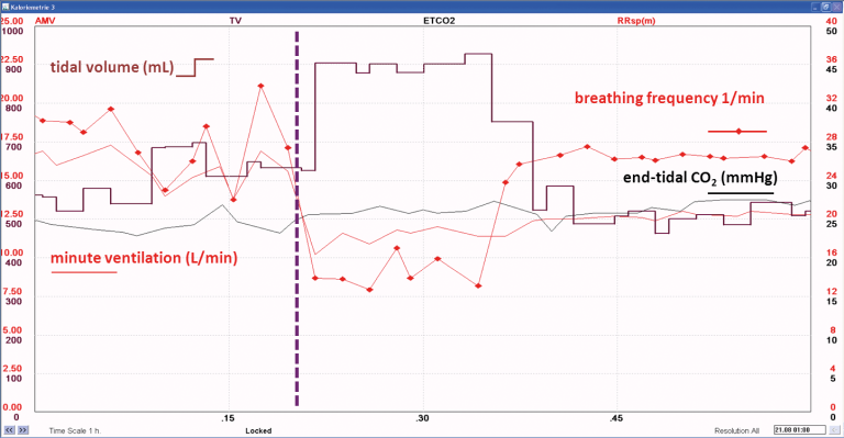 Example of the effect of an acute change in breathing pattern on gas exchange measurements