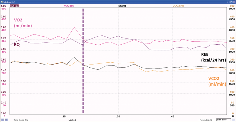 V̇CO₂, RQ, and REE values before and after steady state is achieved