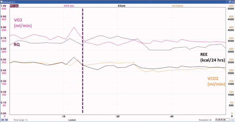 V̇CO₂, RQ, and REE values before and after steady state is achieved 