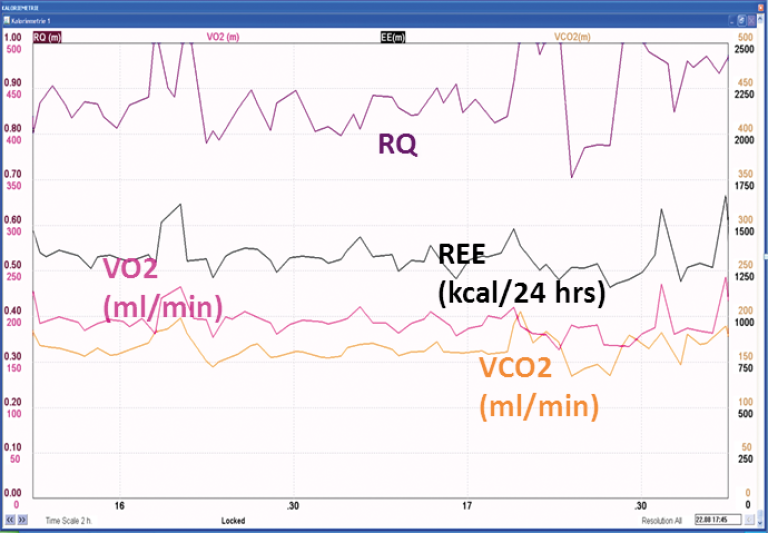 Gas exchange monitoring of a patient at the end of the first week after suffering multiple complications after a Whipple operation