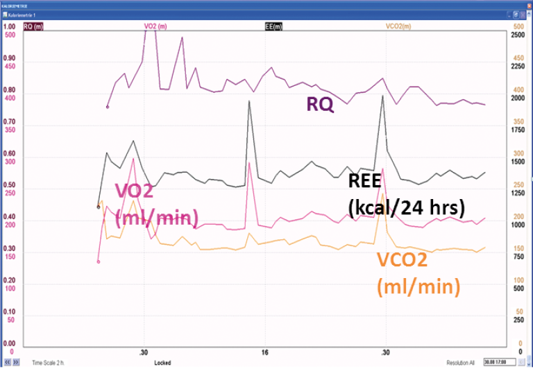 Gas exchange monitoring of a patient at the end of the second week after suffering multiple complications after a Whipple operation