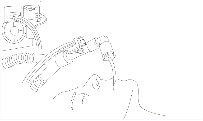 Patient set-up to capture gas exchange measurement