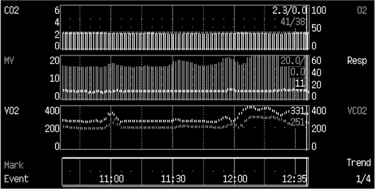 Increase in ventilatory demand