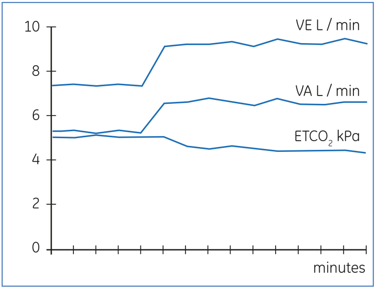 Change in VA in response to increased minute ventilation.