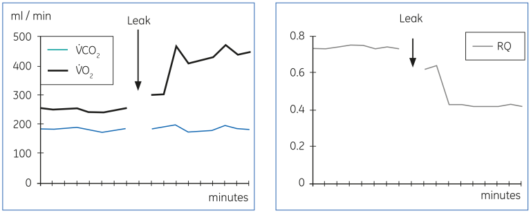 High V̇O₂ and low RQ that result from a leak in the expiratory gas circuit.