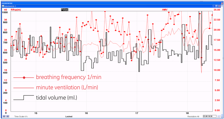 Impact of increased variability on breathing pattern