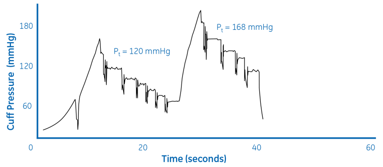 Repump sequence with DINAMAP SuperSTAT algorithm (BP = 147/87)