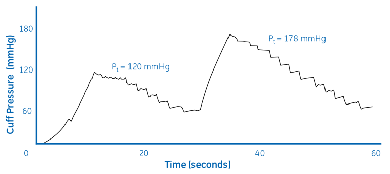 Repump sequence with Classic algorithm (BP= 141/82)