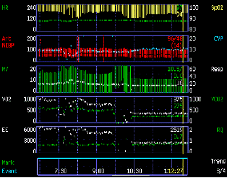 Screenshot of 40 year-old male respiratory  monitor