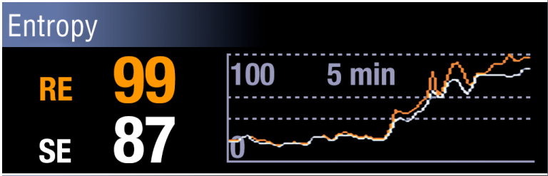 Entropy monitor displaying a rise in both Entropies