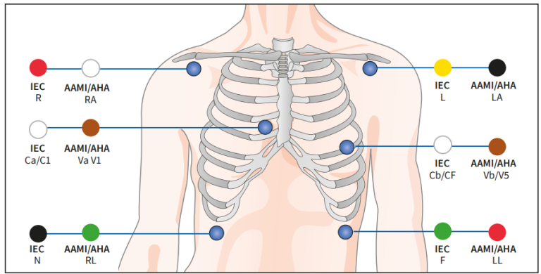 6-lead configuration