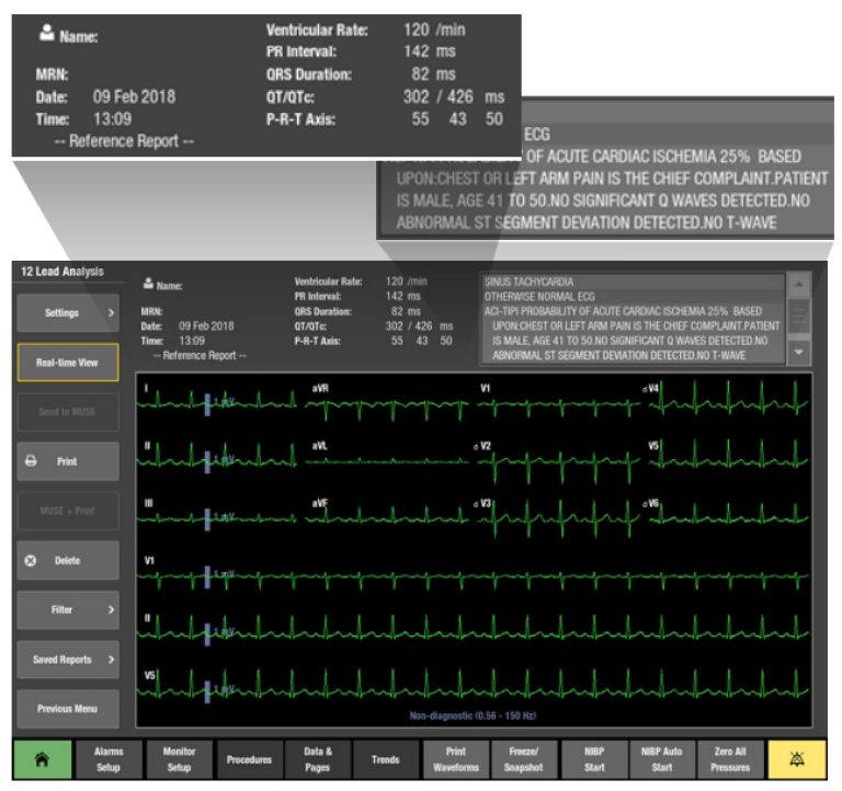 A view of a 12RL report on the monitor screen